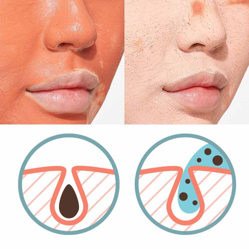 MISSHA | Amazon Red Clay Pore Mask